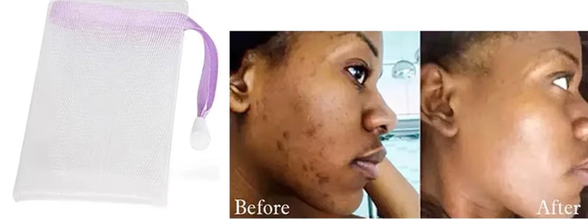 Brightening Turmeric & Kojic Acid Cleansing
Bar!!!